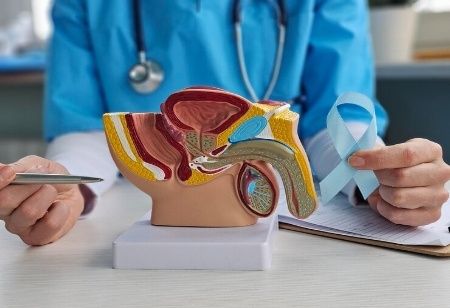  Prostate cancer in India